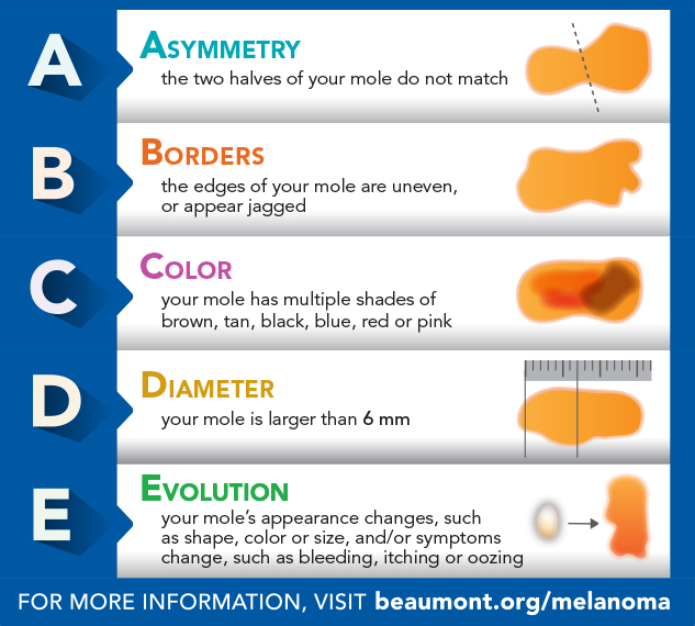 melanoma-infographic