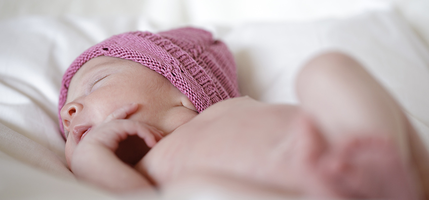 Newborn baby with cystic hygroma