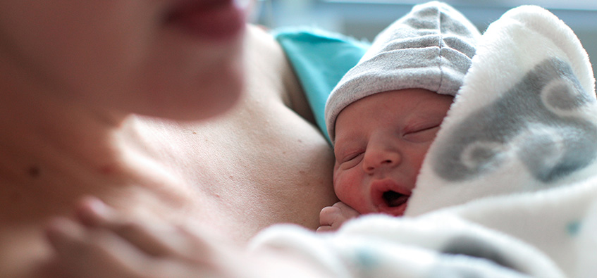 Newborn baby with esophageal atresia or tracheoesophageal fistula