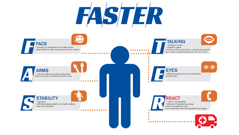 Stroke Symptoms: From FAST to FASTER | Beaumont Health