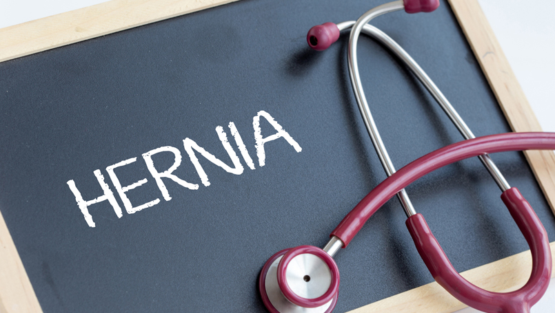 hernia-types-symptoms