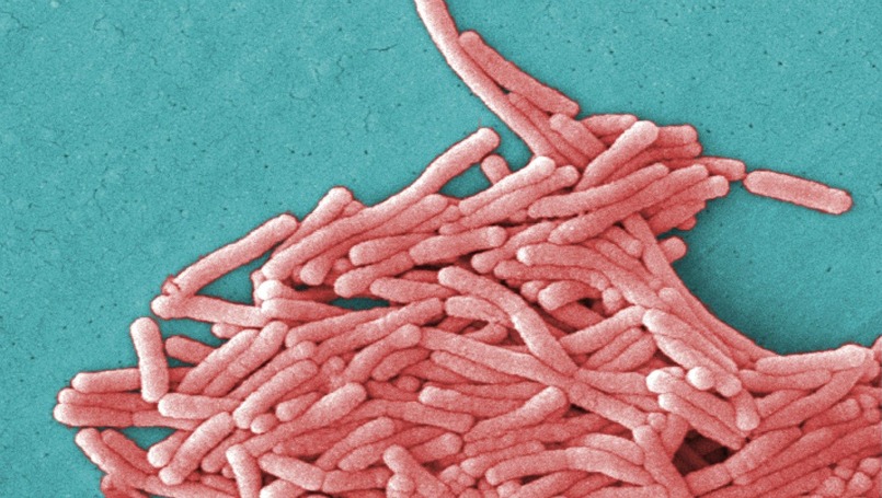 legionnaires-disease