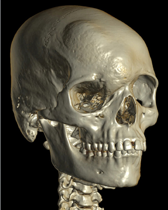 Tagbo 3D skull