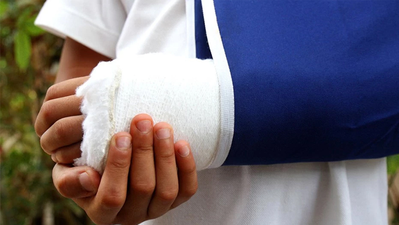 take-care-of-a-broken-bone