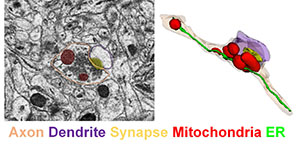 Mitochondrial dysfunction in AD brain