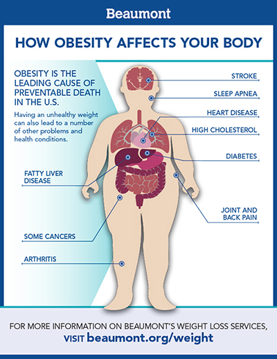 Healthiest weight just might be 'overweight